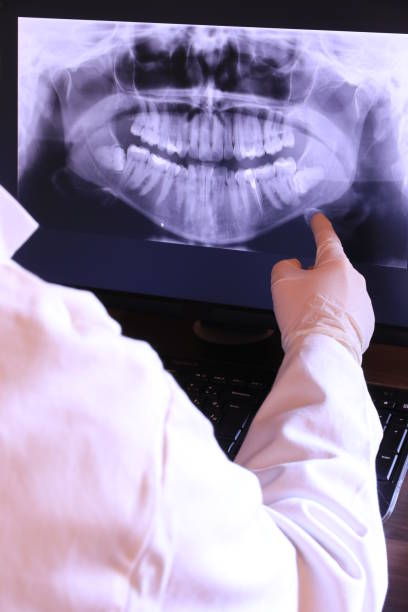 Best Emergency Gum Treatment in Altamont, IL